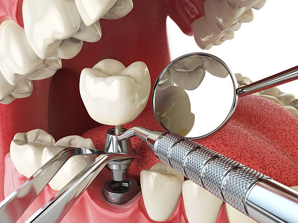 Best Urgent Care for Lost Fillings or Crowns in Lake View, AL